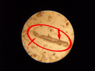 asi nematoda.jpg